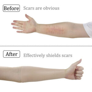 Arm Scar Tattoo Birthmark Obscuration Silicone Sleeve Arm Fattening Thickening Bold Modification - TRANSWEET